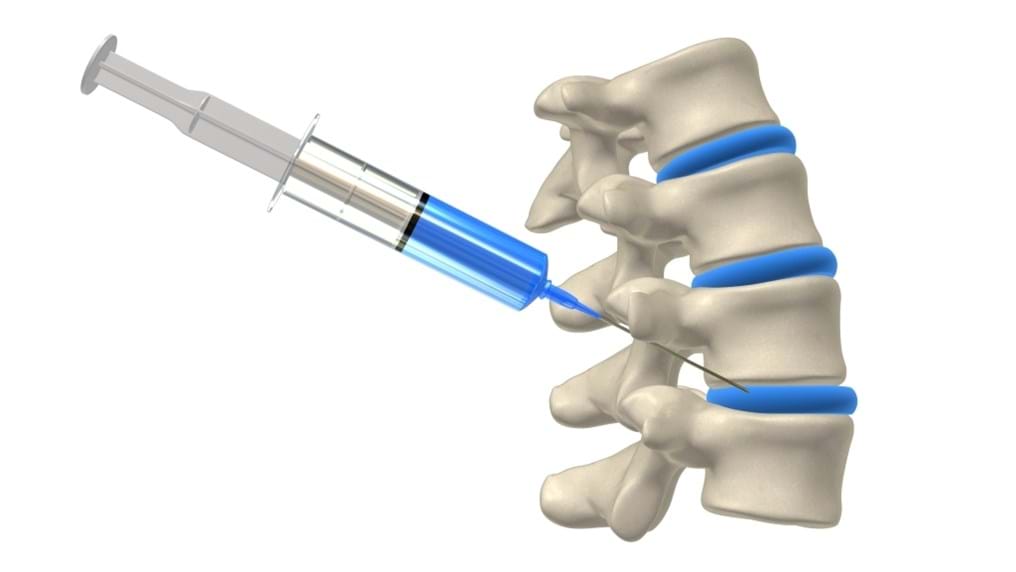 Day 122: Healing help for spinal injuries