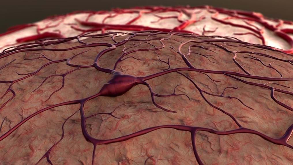 Day 142: Relief for brain injuries