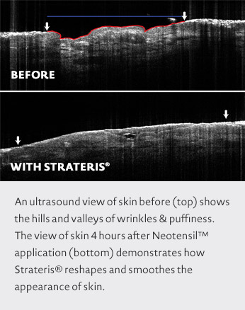 Photo Credit | Living Proof Strateris® Technology