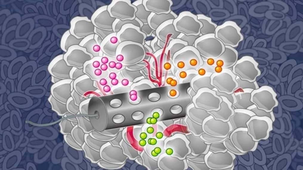 Day 341: Putting the lab into the patient to improve chemotherapy success